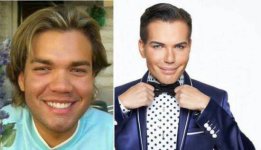 man_has_168000_worth_of_surgery_to_look_like_a_ken_doll_what_could_go_wrong_22_photos20_13994741.jpg