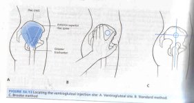ventrogluteal_injection_site.jpg