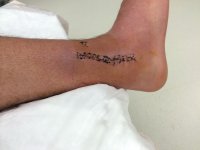 ankle1.jpeg