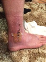 ankle2.jpeg