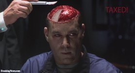 Man-with-Missing-Brain-84988.jpg