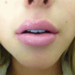 10183179_27_260_260.gif